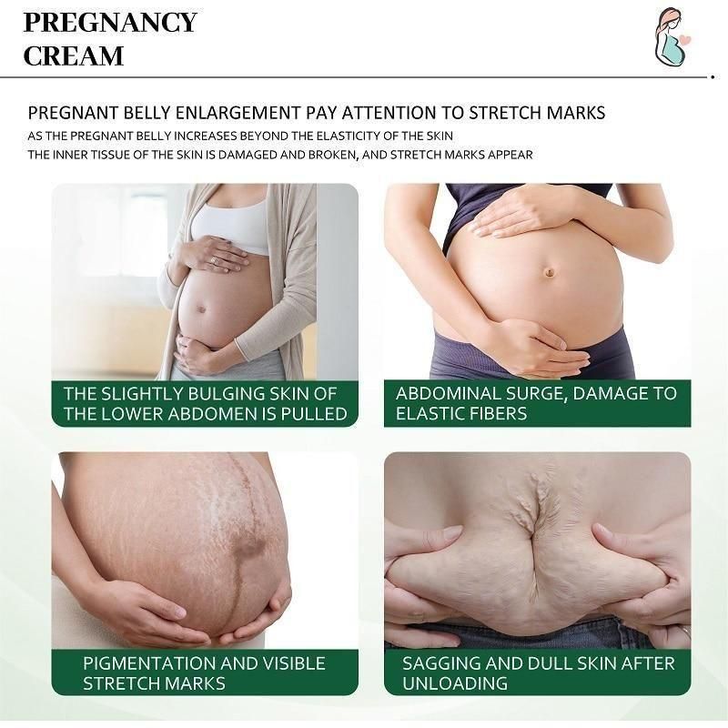 🤩KURAI Pregnancy Scars and Acne Removal Cream🤩