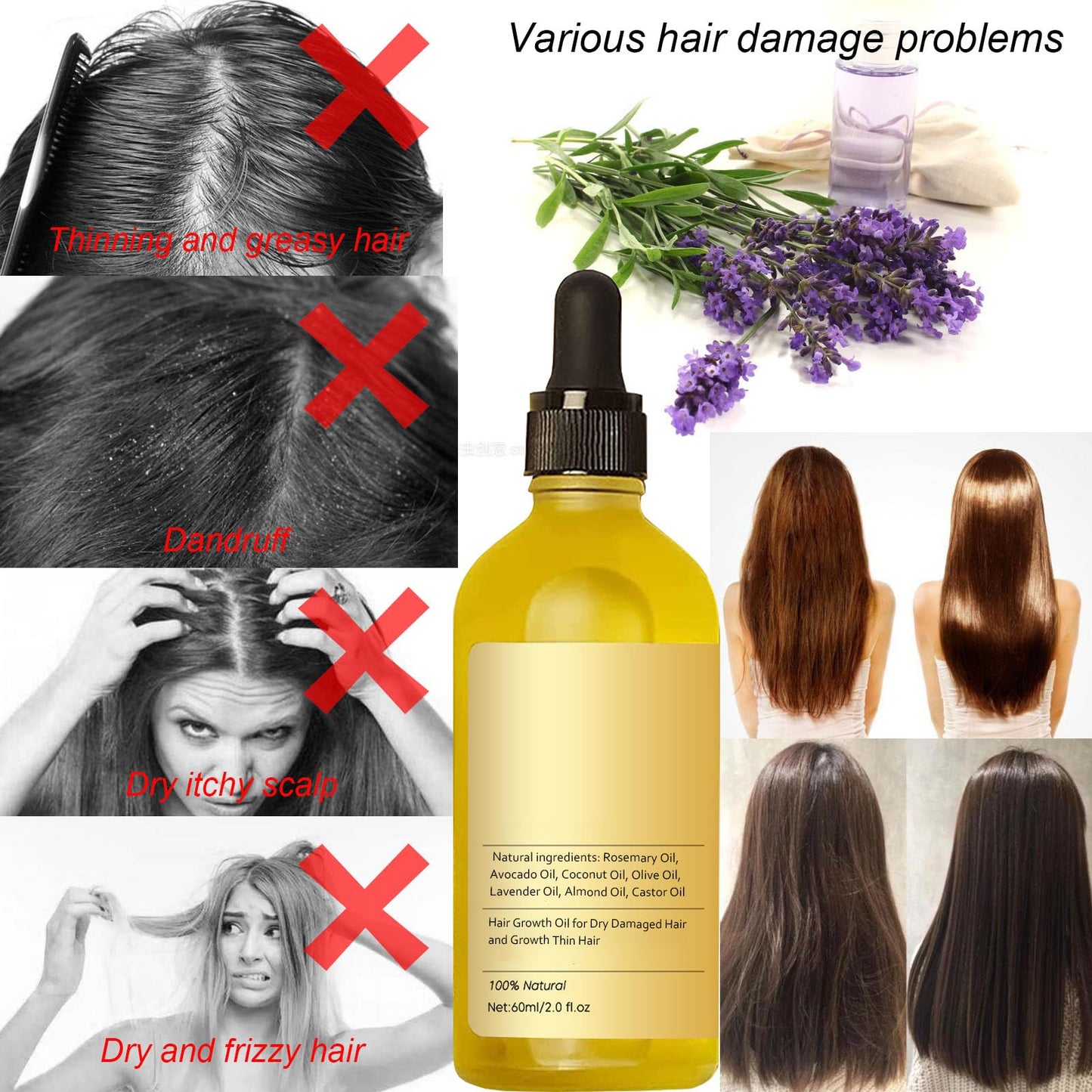 🤩Veganic Natural Hair Growth Oil 30ml [Buy 1 Get 1 free]🤩