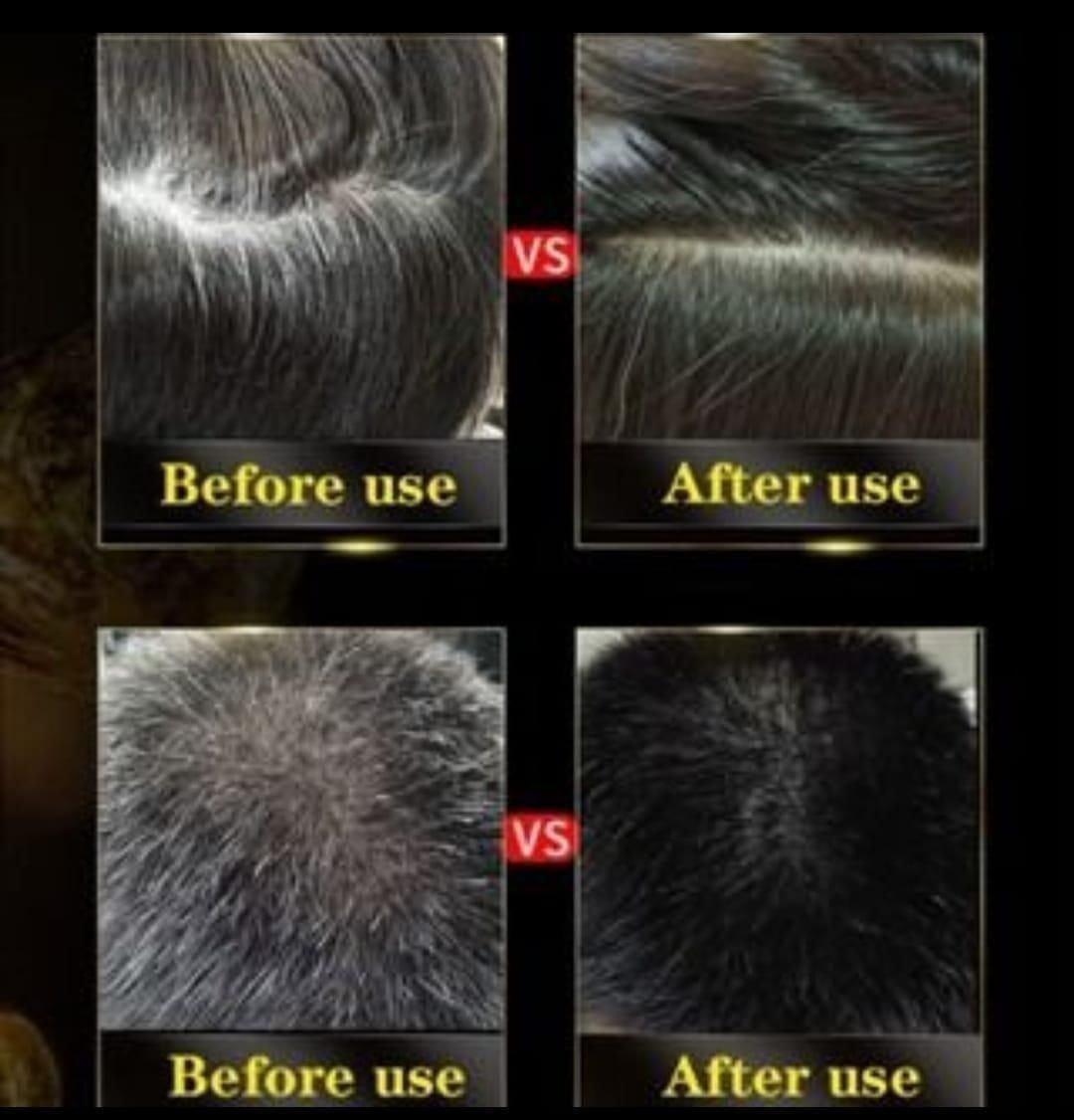 🤩3-IN-1 Black Ayurvedic Hair Dye Shampoo For Grey Hair [🔥Buy 1 Get 1 free🔥]🤩